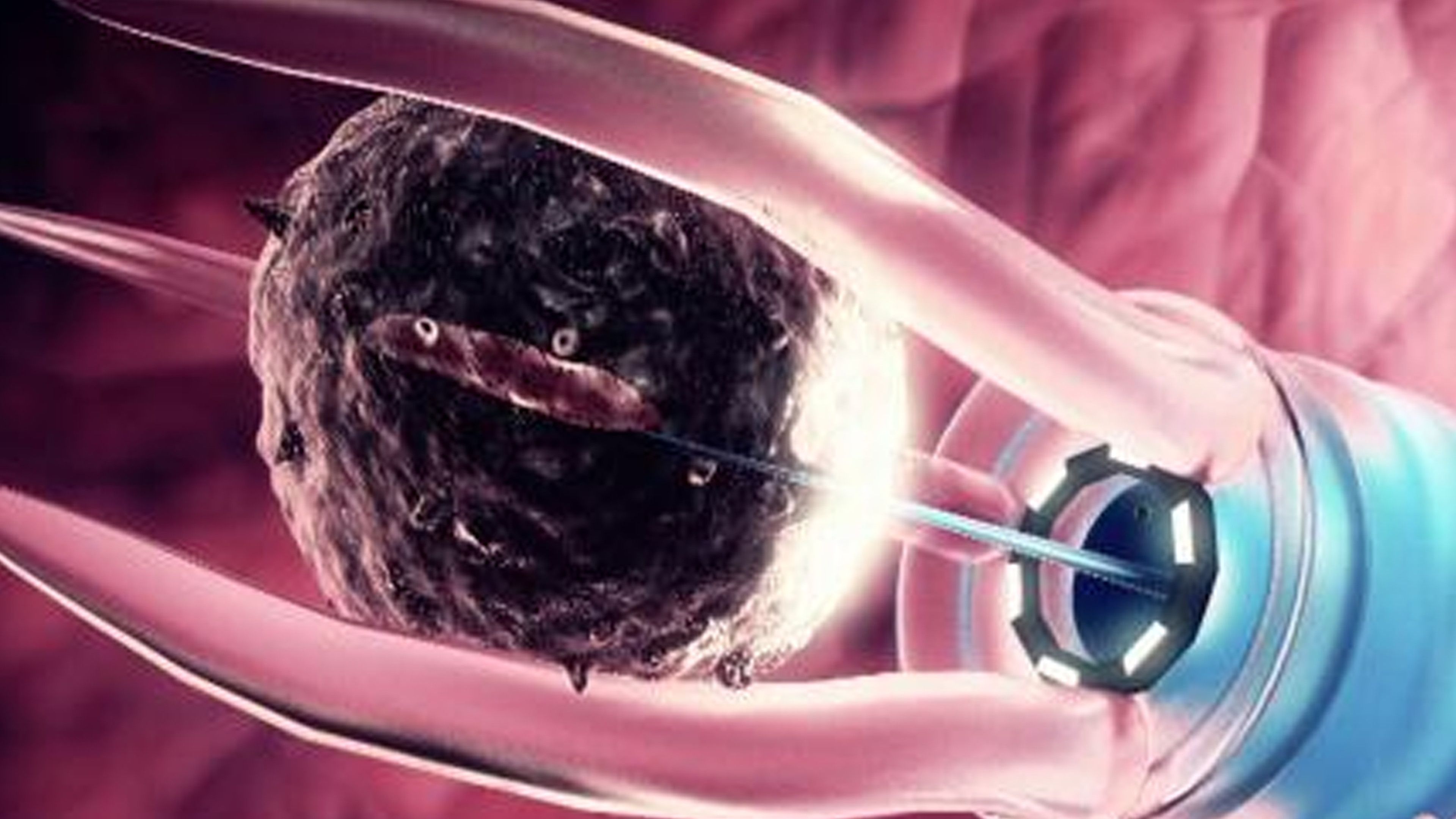 Do Robots Make For Better Surgery?