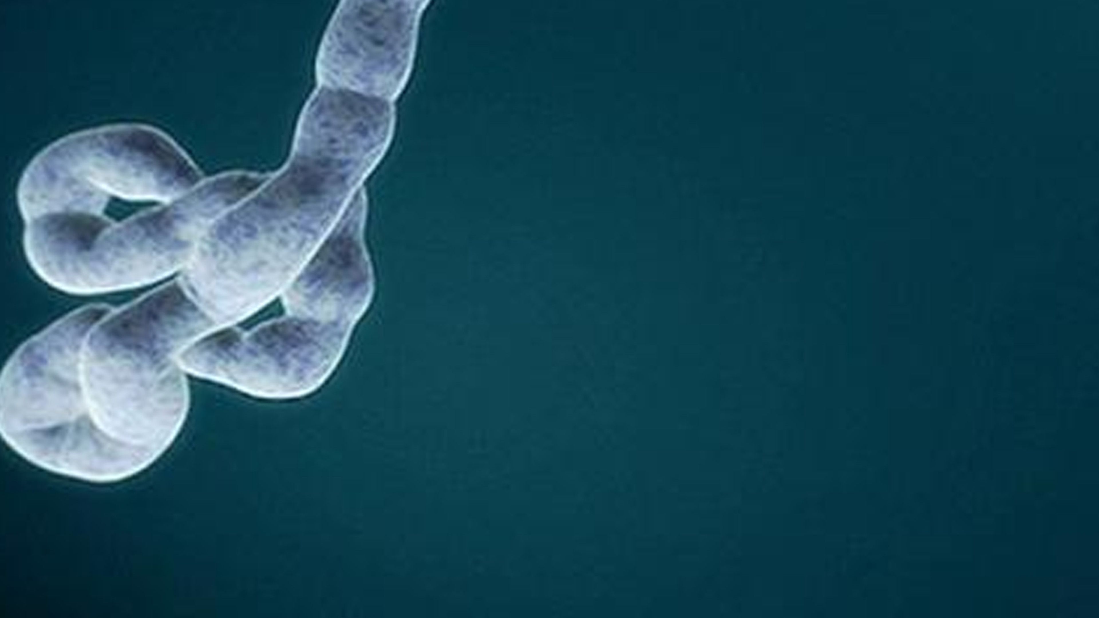 What Is Ebola?